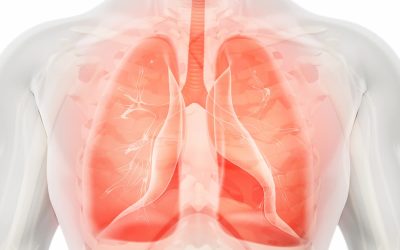 Nivolumab/Relatlimab Shows Feasibility in Resectable NSCLC