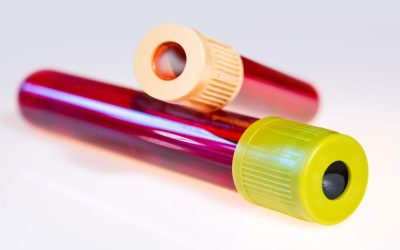 Clinical implementation and current advancement of blood liquid biopsy in cancer